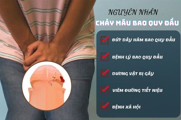 Chảy máu bao quy đầu do nhiều nguyên nhân khác nhau gây ra