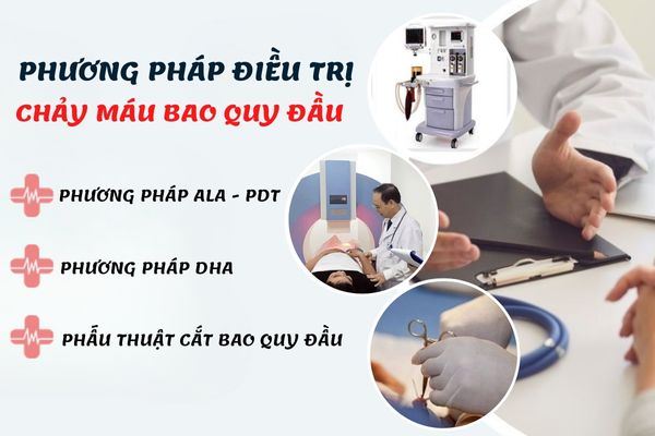 Phương pháp điều trị chảy máu bao quy đầu hiệu quả