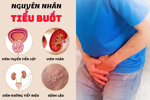 Bệnh lý gây nên triệu chứng tiểu buốt ở nam giới