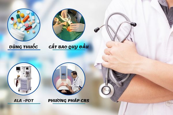 Các phương pháp điều trị đau rát bao quy đầu