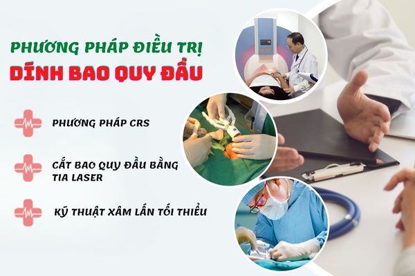 Phương pháp điều trị dính bao quy đầu hiệu quả, an toàn