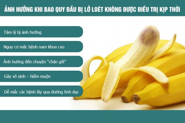 Loét bao quy đầu gây ra nhiều ảnh hưởng đối với sức khỏe nam giới