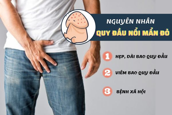 Quy đầu nổi mẩn đỏ cảnh báo nhiều bệnh lý nguy hiểm