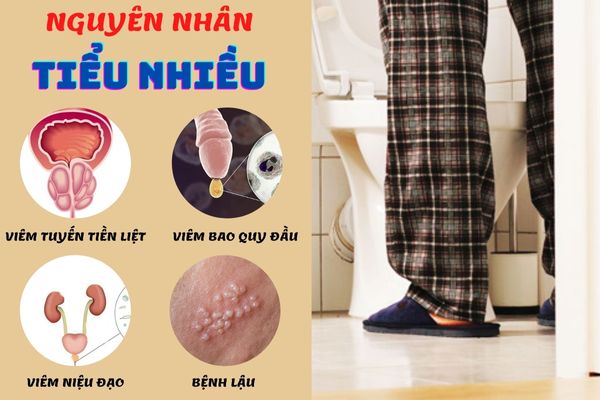 Tiểu nhiều cảnh báo nhiều vấn đề bệnh lý khác nhau