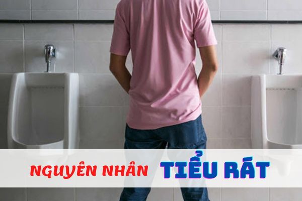 Tiểu rát nguyên nhân do đâu? – Phương pháp điều trị hiệu quả