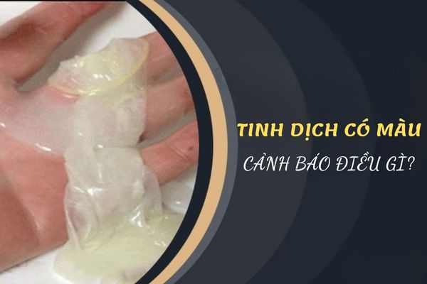 Tinh dịch có màu cảnh báo điều gì? Có nguy hiểm đến sức khỏe không?