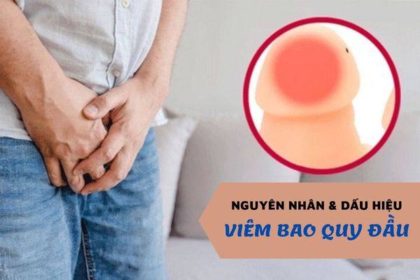 Viêm bao quy đầu là gì – Nguyên nhân và triệu chứng bệnh l