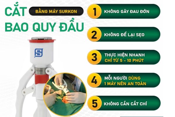 Phương pháp cắt bao quy đầu bằng máy Surkon thế hệ mới