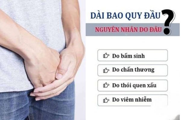 Dài bao quy đầu do nhiều nguyên nhân khác nhau gây ra