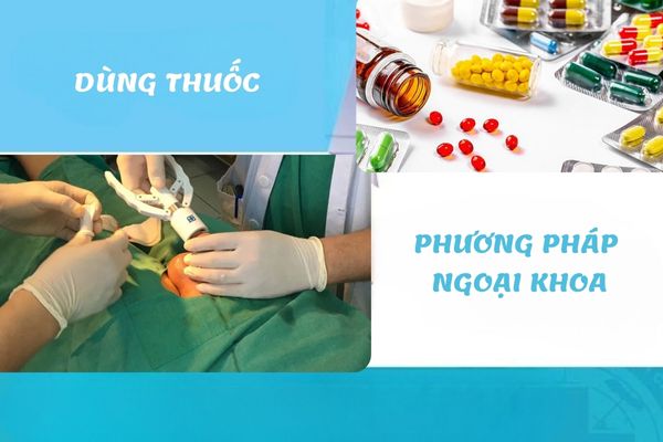 Phương pháp điều trị hẹp bao quy đầu hiệu quả