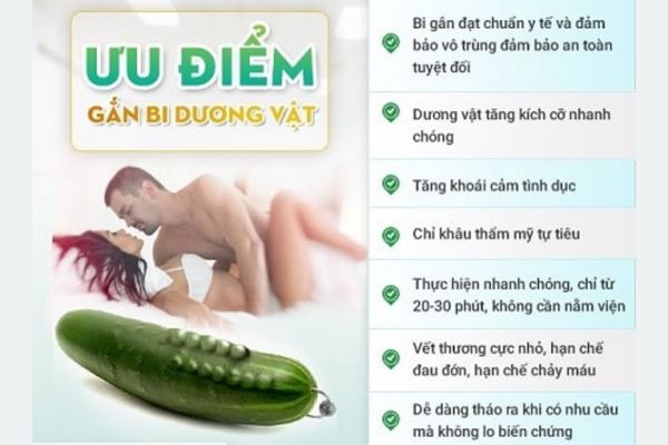 Ưu điểm của phương pháp gắn bi dương vật