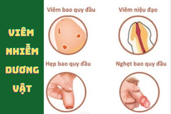 Viêm nhiễm dương vật gây sưng tấy, ngứa rát, khó chịu