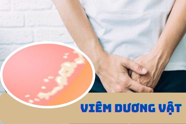 Viêm dương vật – Dấu hiệu nhận biết và cách điều trị hiệu quả