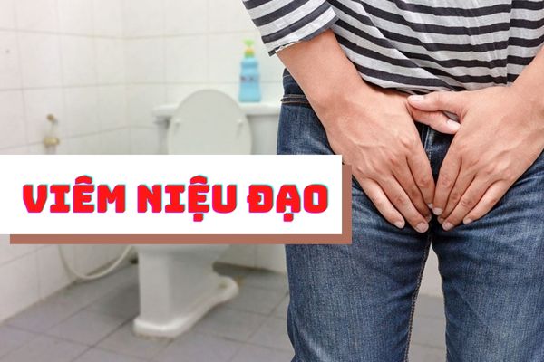 Viêm niệu đạo nam giới – Bệnh lý nguy hiểm không nên chủ quan