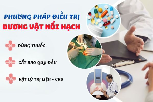 Phương pháp điều trị dương vật nổi hạch hiệu quả