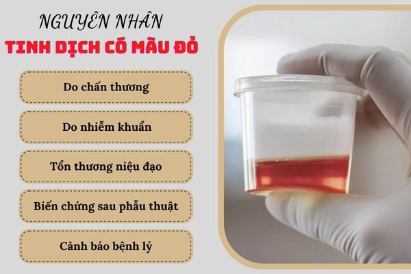 Tinh dịch có màu đỏ do nhiều nguyên nhân khác nhau gây ra