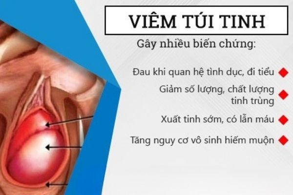 Tinh dịch có màu đỏ là dấu hiệu của bệnh viêm túi tinh