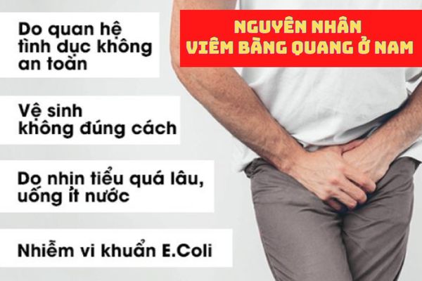 Viêm bàng quang ở nam do nhiều nguyên nhân khác nhau gây ra