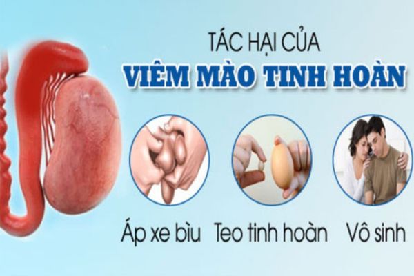 Tác hại của bệnh viêm mào tinh hoàn ở nam giới