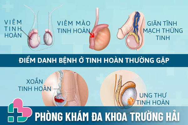 Nhan-dien-som-cac-benh-o-tinh-hoan-1