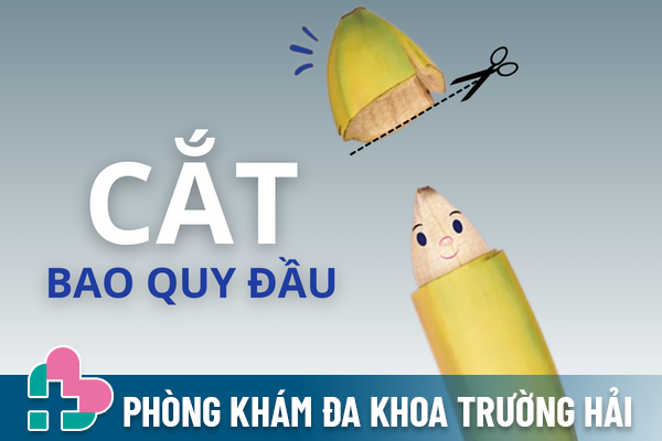 Tất tần tật về phương pháp cắt bao quy đầu