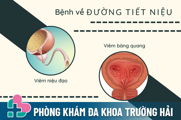 10-benh-nam-khoa-thuong-gap-can-het-suc-luu-y-6