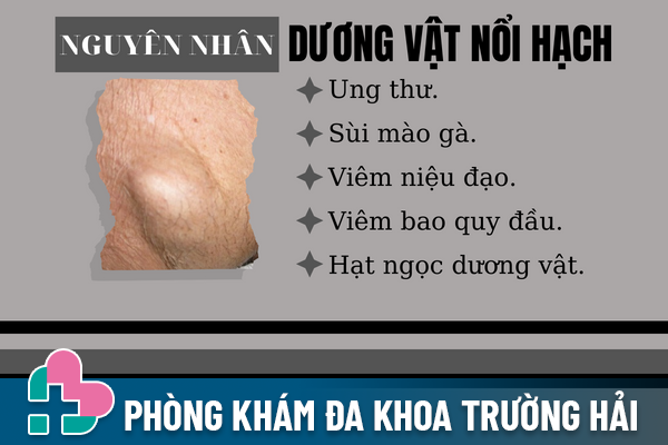 Tai-sao-dot-nhien-duong-vat-noi-hach-01