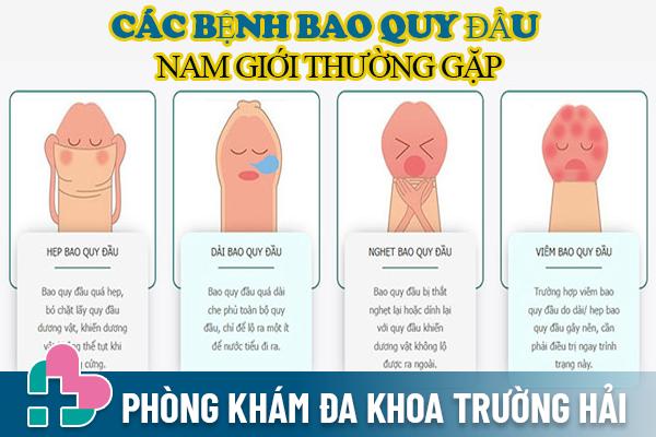 Các bệnh bao quy đầu ở nam giới thường gặp