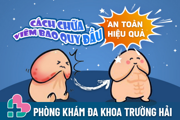 Hỗ trợ chữa viêm bao quy đầu hiệu quả tối ưu