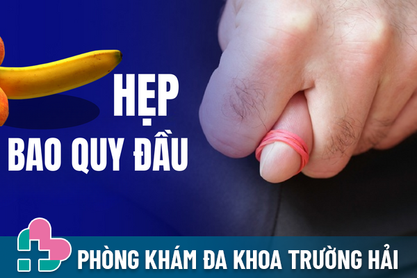 Hẹp bao quy đầu – Hội chứng nguy hiểm phổ biến ở nam giới.