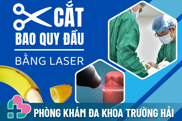 Phương pháp cắt bao quy đầu bằng laser.