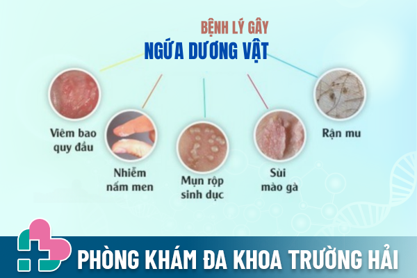 Canh-giac-khi-bi-ngua-duong-vat-1