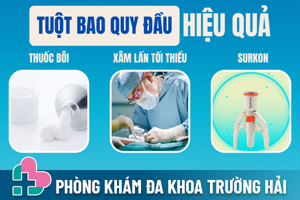 Tuot-bao-quy-dau-kho-khan-do-dau-va-giai-quyet-ra-sao-2