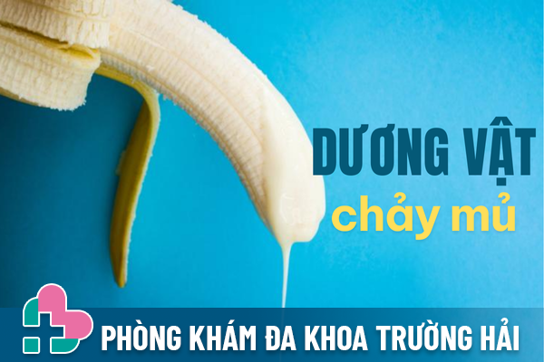 Dương vật chảy mủ cảnh báo bệnh gì?