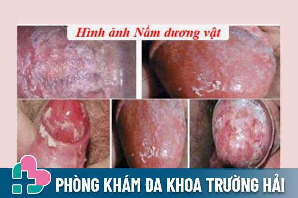 Nam-duong-vat-600x400