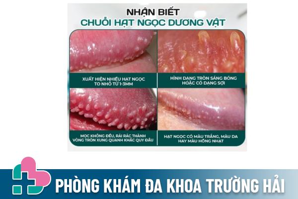 Dau-hieu-hat-ngoc-duong-vat (2)