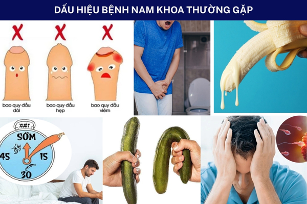 Dấu hiệu bệnh nam khoa thường bị bỏ qua – Đi khám ngay trước khi quá muộn!