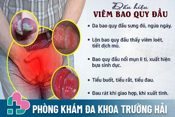 Dau-hieu-viem-bao-quy-dau